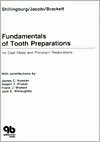 Fundamentals of Tooth Preparations: For Cast Metal and Porcelain Restorations